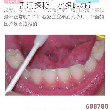 舌头探洞水好多怎么办？你不知道的护理技巧与应对方法分享！