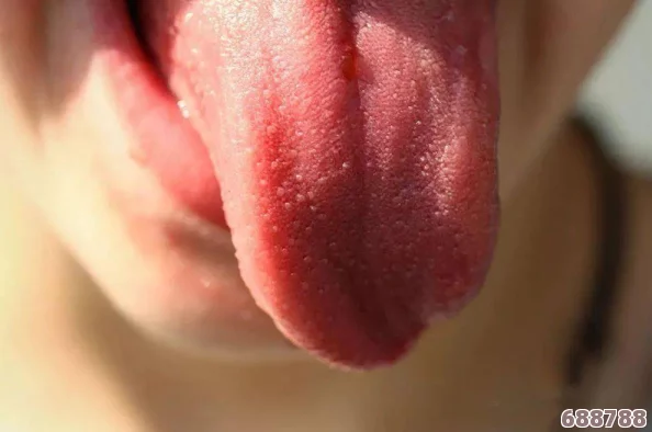 舌头探洞水好多怎么办?你不知道的护理技巧与应对方法分享! 舌头探洞水好多怎么办?你不知道的护理技巧与应对方法分享!